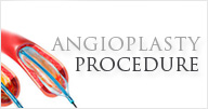 Angioplasty - Norvist