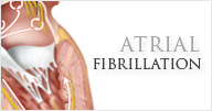 Arterial Fibrillation - Norvist