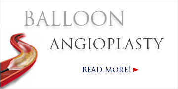 Balloon Angioplasty - Norvist